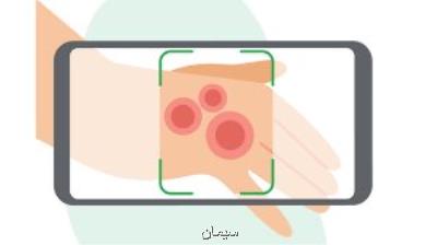 طراحی برنامه ای برای تشخیص و درمان بیماریهای پوستی